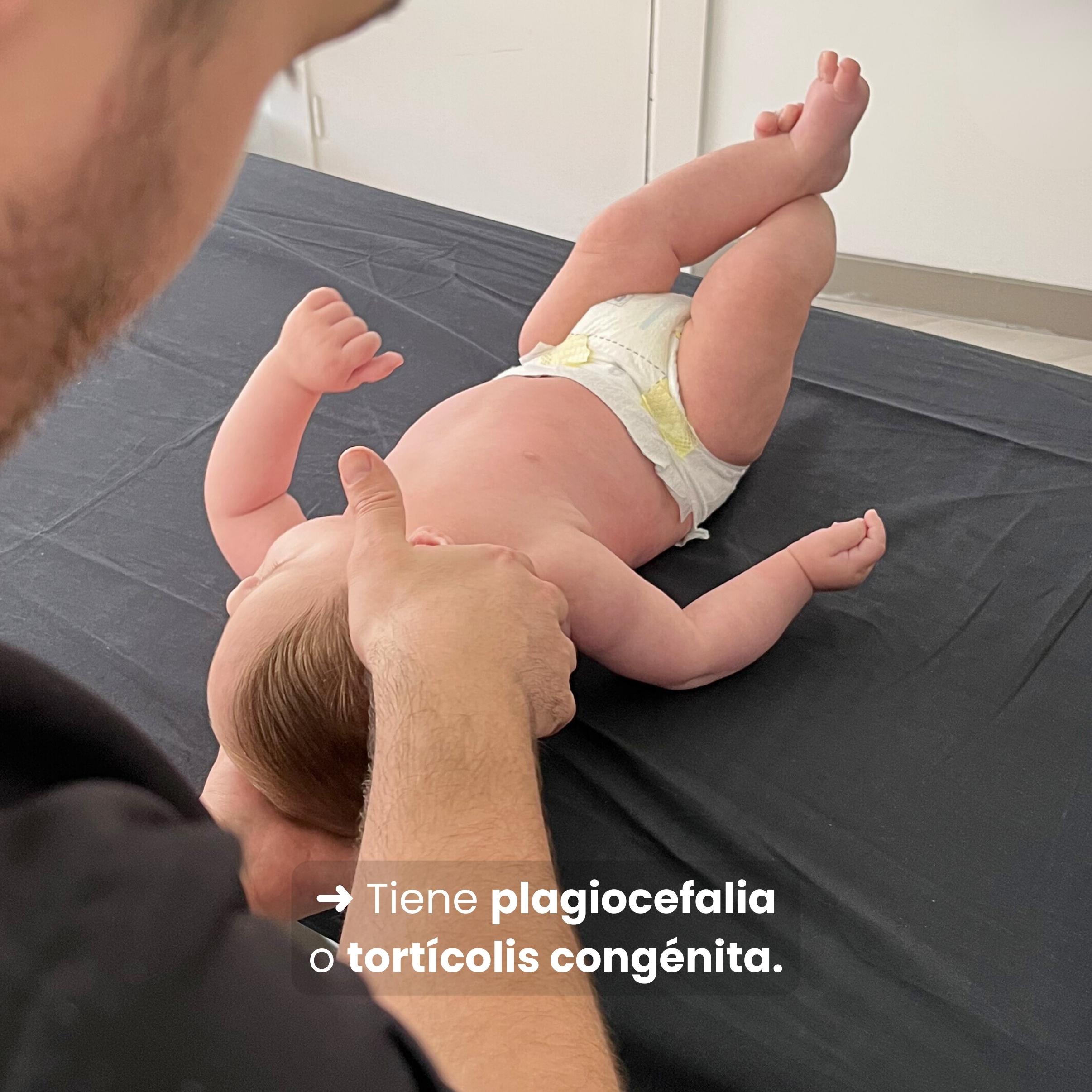Fisioterapia Pediátrica Fisiosan - Asimetría posturales-2